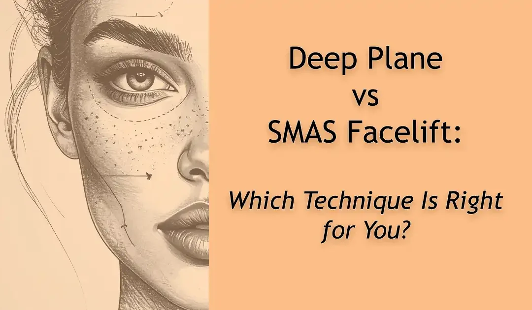 SMAS Facelift vs Deep Plane Facelift