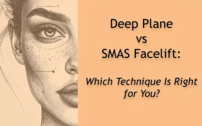 SMAS Facelift vs Deep Plane Facelift