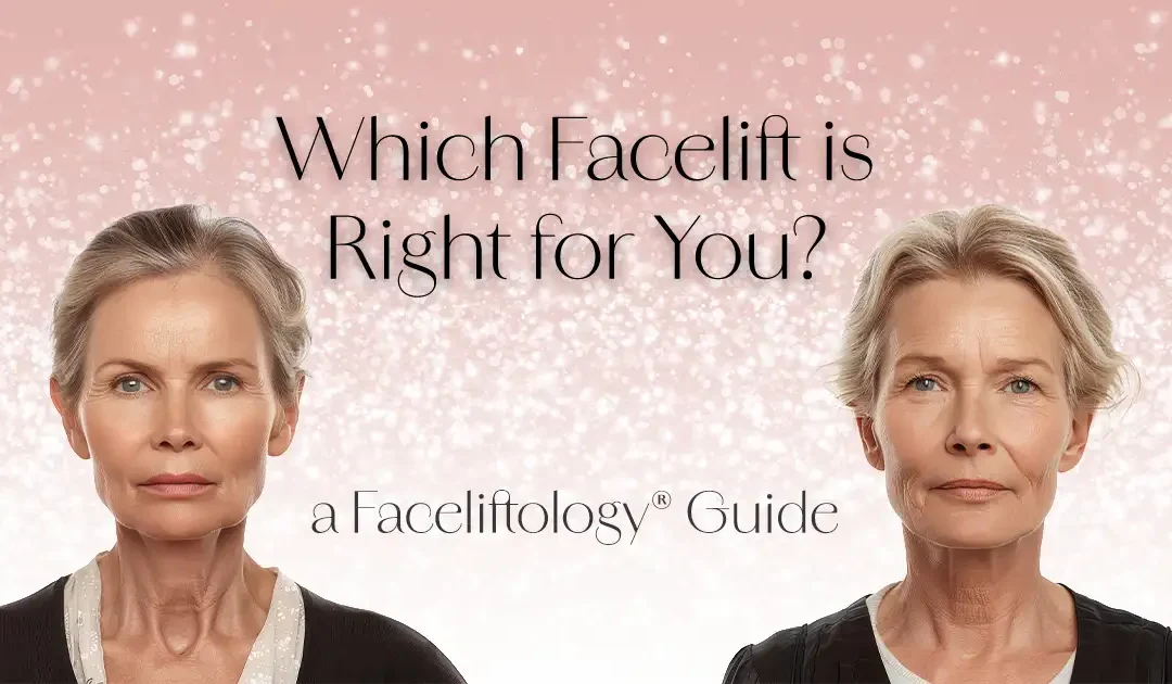 Which facelift is right for you?